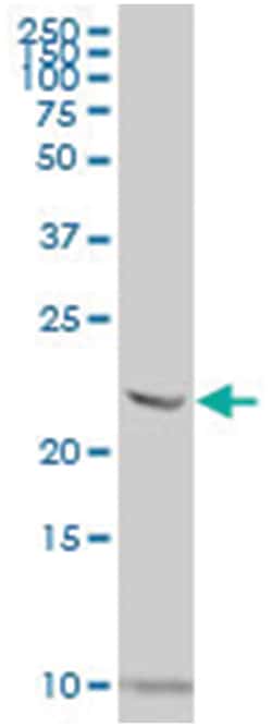 nascent polypeptide-associated complex alpha subunit 2, Mouse, Polyclonal