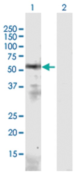 leucine-rich repeat, immunoglobulin-like and transmembrane domains 3, Mouse,