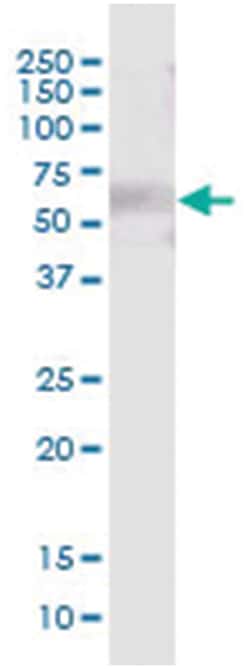 leucine-rich repeat, immunoglobulin-like and transmembrane domains 3, Mouse,