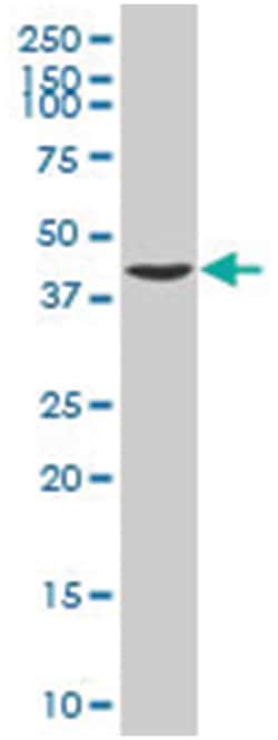 EYS, Mouse, Polyclonal Antibody, Abnova 50&mu;L; Unlabeled:Antibodies,