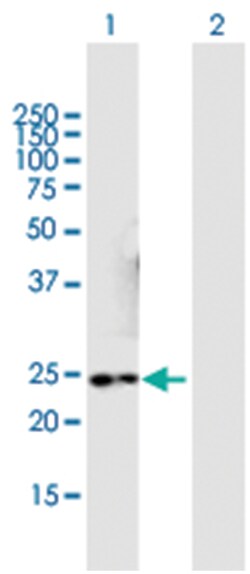 nicotinamide nucleotide adenylyltransferase 3, Mouse, Purified MaxPab Polyclonal