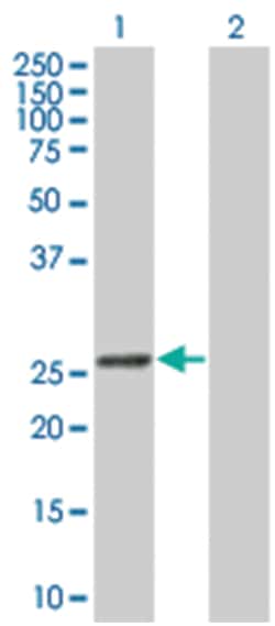 glutathione S-transferase kappa 1, Mouse, Polyclonal Antibody, Abnova 50 &mu;L | Buy Online | Abnova Corporation | Fisher Scientific