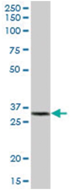 glutathione S-transferase kappa 1, Mouse, Polyclonal Antibody, Abnova 50 &mu;L | Buy Online | Abnova Corporation | Fisher Scientific