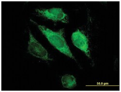 glutathione S-transferase kappa 1, Mouse, Polyclonal Antibody, Abnova 50 &mu;L | Buy Online | Abnova Corporation | Fisher Scientific