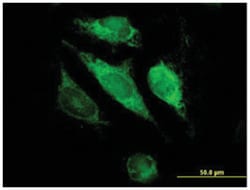 glutathione S-transferase kappa 1, Mouse, Polyclonal Antibody, Abnova 50 &mu;L | Buy Online | Abnova Corporation | Fisher Scientific