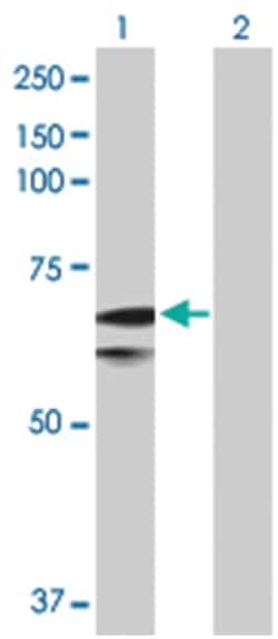solute carrier family 27 (fatty acid transporter), member 1, Rabbit, Purified