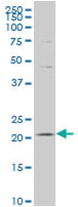 tripartite motif-containing 61, Mouse, Polyclonal Antibody, Abnova 50&mu;L;
