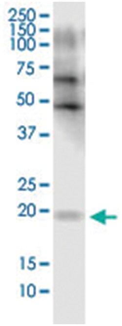 FLJ35767, Mouse, Clone: 2F3, Abnova 100&mu;g; Unlabeled:Antibodies, Monoclonal