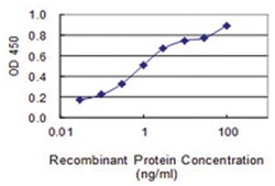 FLJ35767, Mouse, Clone: 2F3, Abnova 100&mu;g; Unlabeled:Antibodies, Monoclonal