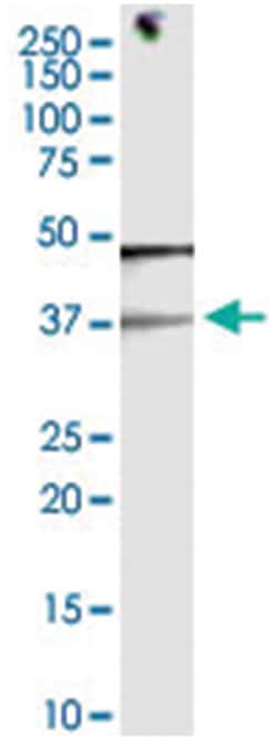 anti-EID3, Clone: 2E5., Abnova 100&mu;g, Unlabeled:Antibodies, Monoclonal