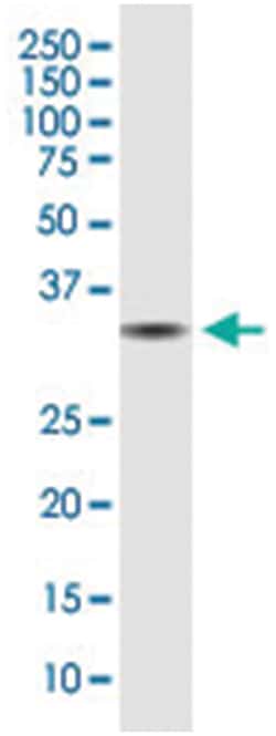 anti-EID3, Clone: 2E5., Abnova 100&mu;g, Unlabeled:Antibodies, Monoclonal