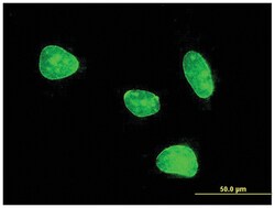 anti-MEF2BNB, Clone: 1B5, Abnova 100 &mu;g | Buy Online | Abnova | Fisher Scientific