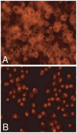 Abnova&trade;&nbsp;SREBF2 Cell-Based Translocation Assay Kit