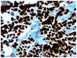 Myog, Mouse, Clone: 5FD, Abnova 100&mu;g; Unlabeled:Antibodies, Monoclonal
