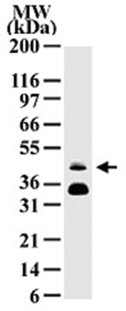 FOSB, Mouse, Clone: 83B1138, Abnova 100&mu;g; Unlabeled:Antibodies, Monoclonal