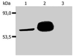 LCK, Mouse, Clone: LCK-01, Abnova 100 &mu;g | Buy Online | Abnova | Fisher Scientific