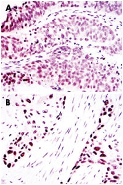 TP63, Mouse, Clone: 4E5, Abnova 100&mu;L; Unlabeled:Antibodies, Monoclonal