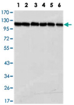 PARP1, Mouse, Clone: 7A10, Abnova 100&mu;L; Unlabeled:Antibodies, Monoclonal