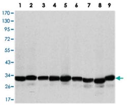 PHB, Mouse, Clone: 5H7, Abnova 100 &mu;L | Buy Online | Abnova | Fisher Scientific