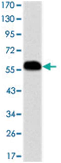 PHB, Mouse, Clone: 5H7, Abnova 100 &mu;L | Buy Online | Abnova | Fisher Scientific