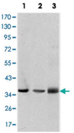 LIMS1, Mouse, Clone: 5G7, Abnova 100&mu;L; Unlabeled:Antibodies, Monoclonal