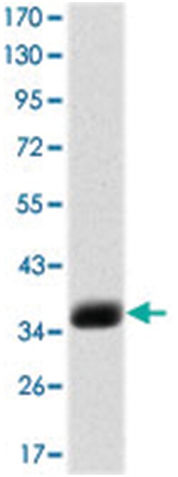LIMS1, Mouse, Clone: 5G7, Abnova 100&mu;L; Unlabeled:Antibodies, Monoclonal