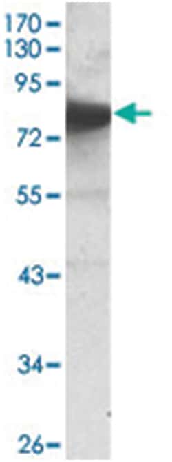 NTRK3, Mouse, Clone: 4G5, Abnova 100&mu;L; Unlabeled:Antibodies, Monoclonal