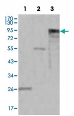 MPO, Mouse, Clone: 9B12G7, 4D8B12, 9B12D9, 9C11A5, Abnova 100&mu;L; Unlabeled:Antibodies,