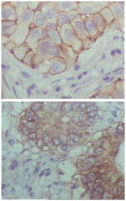 EPHB1, Mouse, Clone: 5F10A4, Abnova 100&mu;L; Unlabeled:Antibodies, Monoclonal