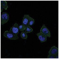 HFE, Mouse, Clone: 3F1, Abnova 100&mu;L; Unlabeled:Antibodies, Monoclonal