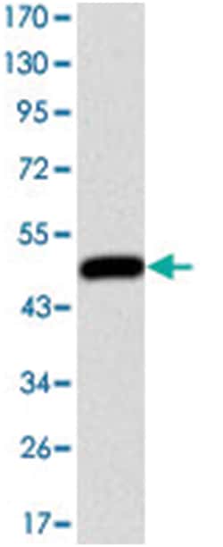 HFE, Mouse, Clone: 3F1, Abnova 100&mu;L; Unlabeled:Antibodies, Monoclonal