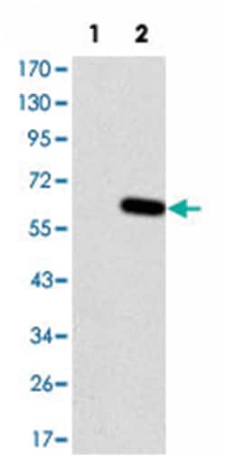 HFE, Mouse, Clone: 3F1, Abnova 100&mu;L; Unlabeled:Antibodies, Monoclonal