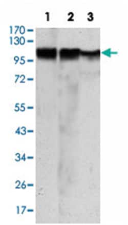 HK2, Mouse, Clone: 3D3, Abnova 100&mu;L; Unlabeled:Antibodies, Monoclonal