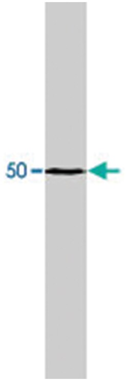 MMP3, Mouse, Clone: 1B4, Abnova 200 &mu;g | Buy Online | Abnova | Fisher Scientific