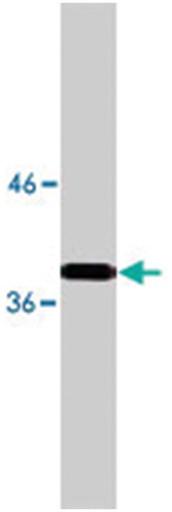 NPDC1, Mouse, Clone: 16E4, Abnova 100 &mu;g | Buy Online | Abnova | Fisher Scientific