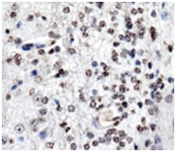 BECN1, Mouse, Clone: 1B7, Abnova 100&mu;L; Unlabeled:Antibodies, Monoclonal