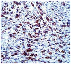 APOA5, Mouse, Clone: 1G5G9, Abnova 100&mu;L; Unlabeled:Antibodies, Monoclonal