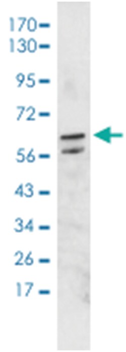 DUX4, Mouse, ATTO488, Clone: P2B1, Abnova 100&mu;g; ATTO488:Antibodies,