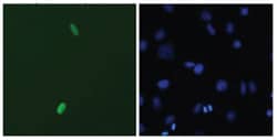 DUX4, Mouse, R-PE, Clone: P2B1, Abnova 100&mu;g; R-PE:Antibodies, Monoclonal