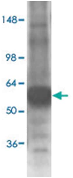 Slc17a7, Mouse, R-PE, Clone: S28-9, Abnova 100&mu;g; R-PE:Antibodies, Monoclonal