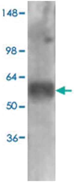 Slc17a6, Mouse, R-PE, Clone: S29-29, Abnova 100&mu;g; R-PE:Antibodies,