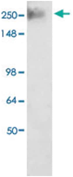 Cacna1g, Mouse, R-PE, Clone: S178A-9, Abnova 100&mu;g; R-PE:Antibodies,