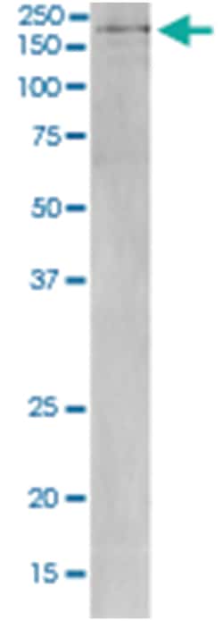 DNMT1, Mouse, APC, Clone: 4G11-C7, Abnova 100&mu;g; APC:Antibodies, Monoclonal