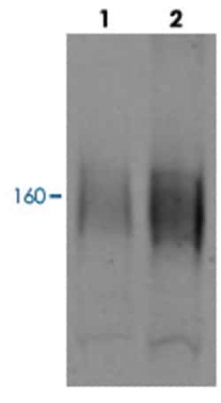 SLC12A3, Rabbit, ATTO594, Polyclonal Antibody, Abnova 100 &mu;g | Buy Online | Abnova Corporation | Fisher Scientific