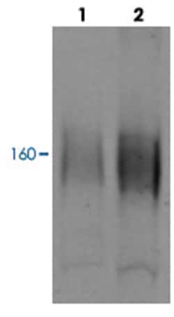 SLC12A3, Rabbit, HRP, Polyclonal Antibody, Abnova 100 &mu;g | Buy Online | Abnova Corporation | Fisher Scientific
