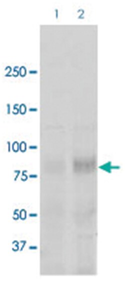 Scnn1a, Rabbit, ATTO390, Polyclonal Antibody, Abnova 100 &mu;g | Buy Online | Abnova | Fisher Scientific