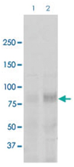 Scnn1a, Rabbit, ATTO488, Polyclonal Antibody, Abnova 100 &mu;g | Buy Online | Abnova | Fisher Scientific