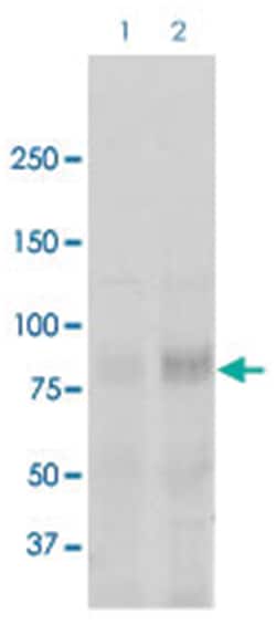 Scnn1a, Rabbit, Biotin, Polyclonal Antibody, Abnova 100&mu;g; Biotin:Antibodies,