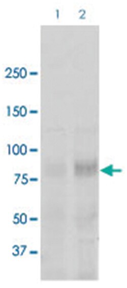 Scnn1a, Rabbit, PerCP, Polyclonal Antibody, Abnova 100 &mu;g | Buy Online | Abnova Corporation | Fisher Scientific