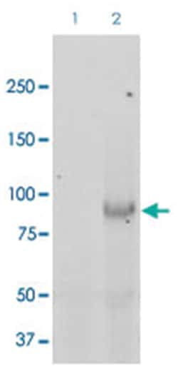 SCNN1B, Rabbit, ATTO488, Polyclonal Antibody, Abnova 100 &mu;g | Buy Online | Abnova | Fisher Scientific